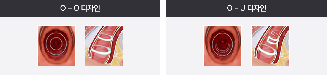 O-O 디자인 / O-U 디자인
