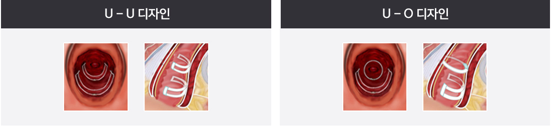 U-U 디자인 / U-O 디자인