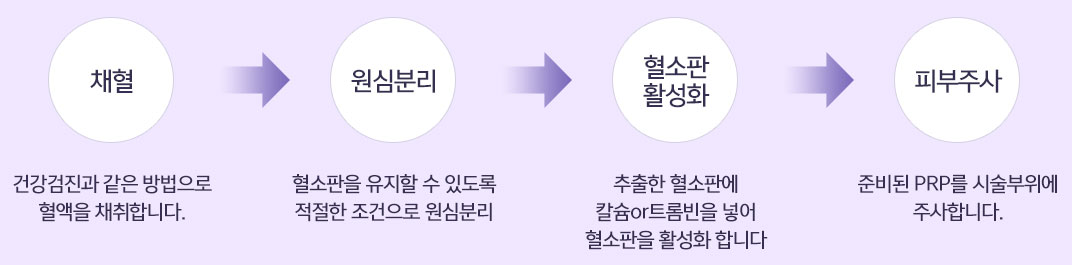 PRP 과정 — 채혈 → 원심분리 → 혈소판 활성화 → 피부주사